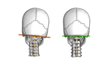 Specialized Upper Cervical Chiropractic Care