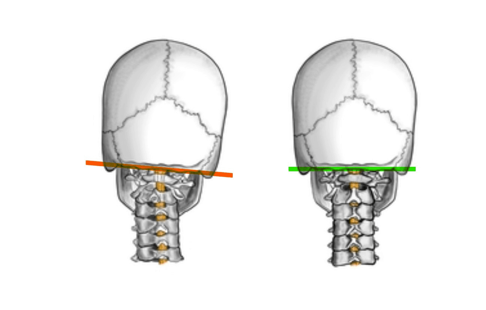 Specialized Upper Cervical Chiropractic Care