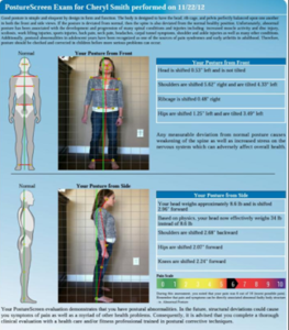 Postural Evaluation showing distortions from spinal stress