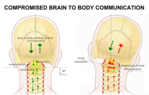 Compromised brain-body communication at the upper cervical spine