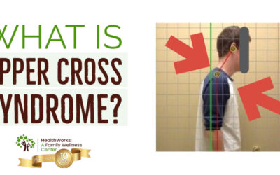 What Is Upper Cross Syndrome?