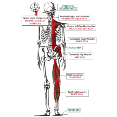 Poor Posture Can Make You Old – FAST!