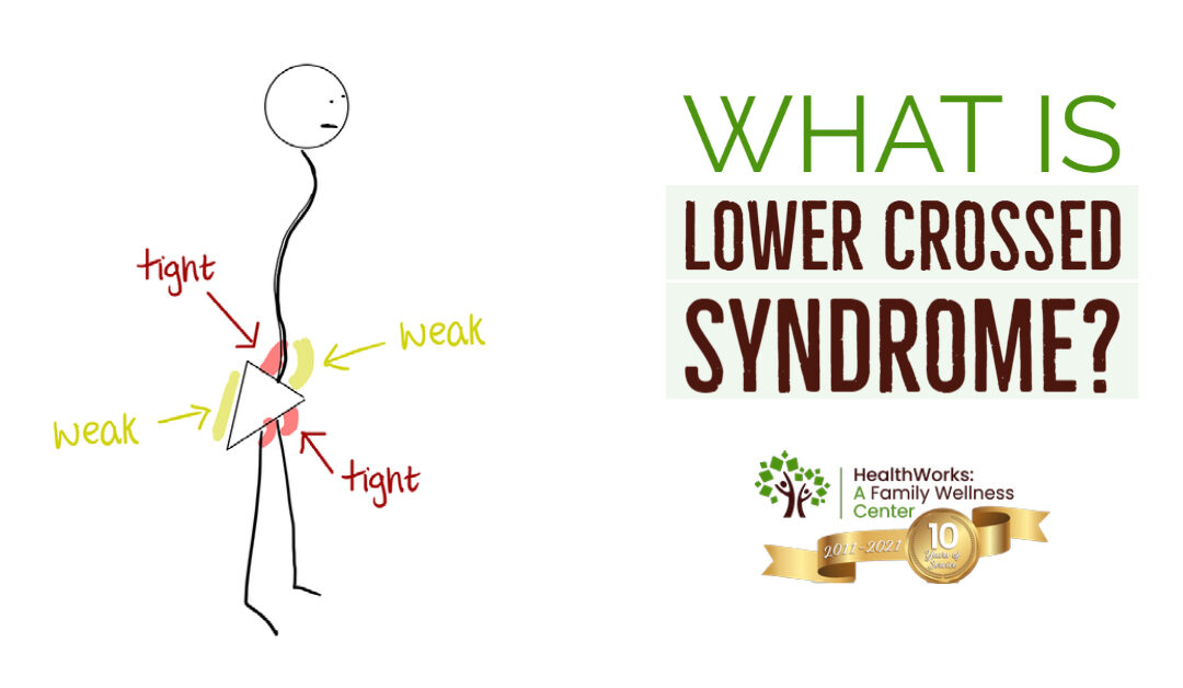 What Is Lower Crossed Syndrome?