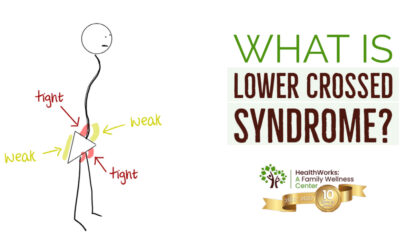 What Is Lower Crossed Syndrome?