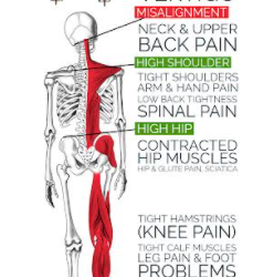 Can Atlas Subluxation Be Fixed?