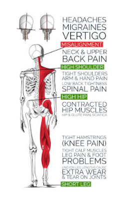 Can Atlas Subluxation Be Fixed?