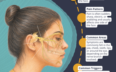 Trigeminal Neuralgia in Waco: When Face Pain Has Been Ruled Out Everywhere Else